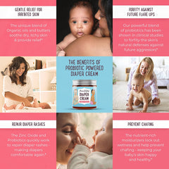 Benefits of probiotic-powered diaper cream